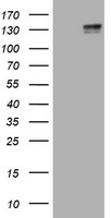 c-Kit / CD117 Antibody - HEK293T cells were transfected with the pCMV6-ENTRY control (Left lane) or pCMV6-ENTRY KIT (Right lane) cDNA for 48 hrs and lysed. Equivalent amounts of cell lysates (5 ug per lane) were separated by SDS-PAGE and immunoblotted with anti-KIT.