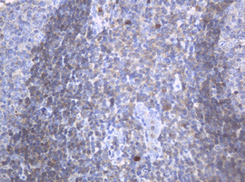 c-Kit / CD117 Antibody - IHC of paraffin-embedded Human tonsil using anti-KIT mouse monoclonal antibody.