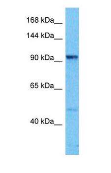 c-Kit / CD117 Antibody - Western blot of KIT Antibody with human 293T Whole Cell lysate.  This image was taken for the unconjugated form of this product. Other forms have not been tested.