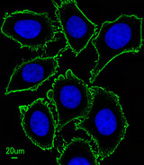 c-Kit / CD117 Antibody - Immunofluorescence of U251 cells, using KIT Antibody. Antibody was diluted at 1:100 dilution. Dylight Fluor 488-conjugated goat anti-mouse lgG at 1:400 dilution was used as the secondary antibody (green). Cytoplasmic actin was counterstained with Dylight Fluor 554 (red) conjugated Phalloidin (red).