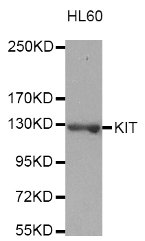 c-Kit / CD117 Antibody - Western blot analysis of extracts of HL60 cells.