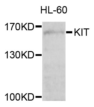 c-Kit / CD117 Antibody - Western blot analysis of extracts of HL-60 cells, using KIT antibody at 1:1000 dilution. The secondary antibody used was an HRP Goat Anti-Rabbit IgG (H+L) at 1:10000 dilution. Lysates were loaded 25ug per lane and 3% nonfat dry milk in TBST was used for blocking. An ECL Kit was used for detection and the exposure time was 10s.