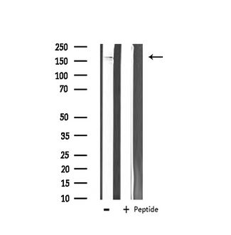 c-Kit / CD117 Antibody - Western blot analysis of KIT expression in HepG2 whole cells lysates. The lane on the left is treated with the antigen-specific peptide.