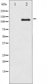c-Kit / CD117 Antibody - Western blot analysis of c-Kit expression in HeLa whole cells lysates. The lane on the left is treated with the antigen-specific peptide.
