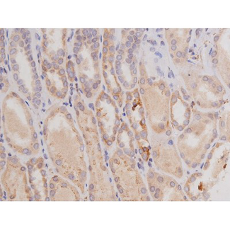 c-Kit / CD117 Antibody - 1:200 staining human kidney tissue by IHC-P. The tissue was formaldehyde fixed and a heat mediated antigen retrieval step in citrate buffer was performed. The tissue was then blocked and incubated with the antibody for 1.5 hours at 22°C. An HRP conjugated goat anti-rabbit antibody was used as the secondary.