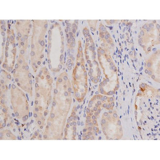 c-Kit / CD117 Antibody - 1:200 staining human kidney tissue by IHC-P. The tissue was formaldehyde fixed and a heat mediated antigen retrieval step in citrate buffer was performed. The tissue was then blocked and incubated with the antibody for 1.5 hours at 22°C. An HRP conjugated goat anti-rabbit antibody was used as the secondary.