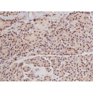 c-Kit / CD117 Antibody - 1:200 staining human pancreas tissue by IHC-P. The tissue was formaldehyde fixed and a heat mediated antigen retrieval step in citrate buffer was performed. The tissue was then blocked and incubated with the antibody for 1.5 hours at 22°C. An HRP conjugated goat anti-rabbit antibody was used as the secondary.