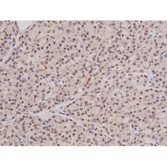 c-Kit / CD117 Antibody - 1:200 staining human pancreas tissue by IHC-P. The tissue was formaldehyde fixed and a heat mediated antigen retrieval step in citrate buffer was performed. The tissue was then blocked and incubated with the antibody for 1.5 hours at 22°C. An HRP conjugated goat anti-rabbit antibody was used as the secondary.