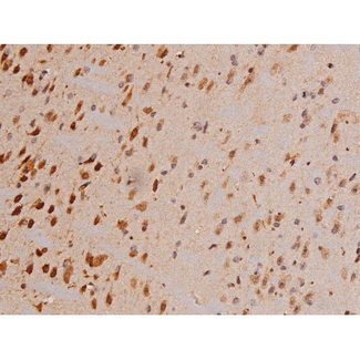 c-Kit / CD117 Antibody - 1:200 staining mouse brain tissue by IHC-P. The tissue was formaldehyde fixed and a heat mediated antigen retrieval step in citrate buffer was performed. The tissue was then blocked and incubated with the antibody for 1.5 hours at 22°C. An HRP conjugated goat anti-rabbit antibody was used as the secondary.