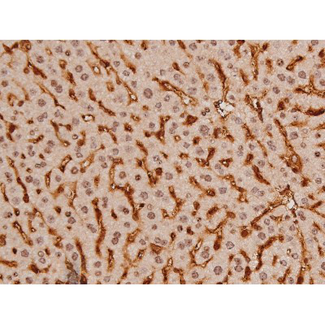 c-Kit / CD117 Antibody - 1:200 staining mouse liver tissue by IHC-P. The tissue was formaldehyde fixed and a heat mediated antigen retrieval step in citrate buffer was performed. The tissue was then blocked and incubated with the antibody for 1.5 hours at 22°C. An HRP conjugated goat anti-rabbit antibody was used as the secondary.