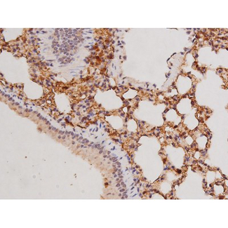 c-Kit / CD117 Antibody - 1:200 staining mouse lung tissue by IHC-P. The tissue was formaldehyde fixed and a heat mediated antigen retrieval step in citrate buffer was performed. The tissue was then blocked and incubated with the antibody for 1.5 hours at 22°C. An HRP conjugated goat anti-rabbit antibody was used as the secondary.