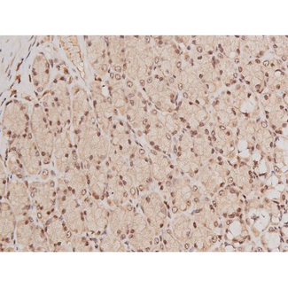 c-Kit / CD117 Antibody - 1:200 staining rat ganstric tissue by IHC-P. The tissue was formaldehyde fixed and a heat mediated antigen retrieval step in citrate buffer was performed. The tissue was then blocked and incubated with the antibody for 1.5 hours at 22°C. An HRP conjugated goat anti-rabbit antibody was used as the secondary.