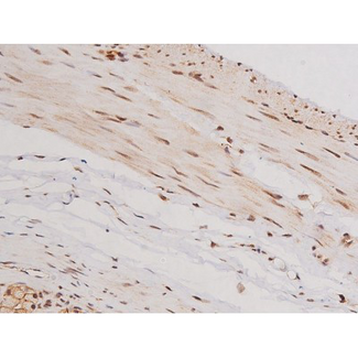 c-Kit / CD117 Antibody - 1:200 staining rat ganstric tissue by IHC-P. The tissue was formaldehyde fixed and a heat mediated antigen retrieval step in citrate buffer was performed. The tissue was then blocked and incubated with the antibody for 1.5 hours at 22°C. An HRP conjugated goat anti-rabbit antibody was used as the secondary.