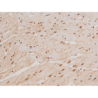 c-Kit / CD117 Antibody - 1:200 staining rat heart tissue by IHC-P. The tissue was formaldehyde fixed and a heat mediated antigen retrieval step in citrate buffer was performed. The tissue was then blocked and incubated with the antibody for 1.5 hours at 22°C. An HRP conjugated goat anti-rabbit antibody was used as the secondary.