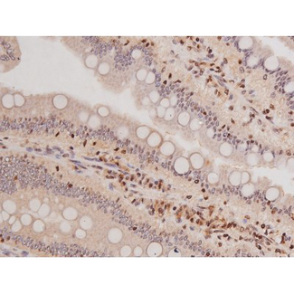 c-Kit / CD117 Antibody - 1:200 staining rat intestinal tissue by IHC-P. The tissue was formaldehyde fixed and a heat mediated antigen retrieval step in citrate buffer was performed. The tissue was then blocked and incubated with the antibody for 1.5 hours at 22°C. An HRP conjugated goat anti-rabbit antibody was used as the secondary.