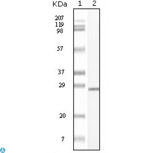 c-Kit / CD117 Antibody - Immunohistochemistry (IHC) analysis of paraffin-embedded maligant mesenchymoma tissues, showing cytoplasmic localization with DAB staining using c-Kit Monoclonal Antibody.