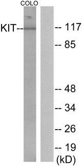 c-Kit / CD117 Antibody - Western blot analysis of extracts from COLO205 cells, using KIT (Ab-936) antibody.