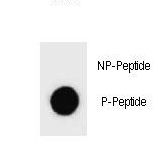 c-Kit / CD117 Antibody - Dot blot of Phospho-KIT-S746 Antibody Phospho-specific antibody on nitrocellulose membrane. 50ng of Phospho-peptide or Non Phospho-peptide per dot were adsorbed. Antibody working concentrations are 0.6ug per ml.
