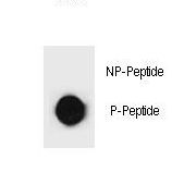 c-Kit / CD117 Antibody - Dot blot of KIT Antibody (Phospho S891) Phospho-specific antibody on nitrocellulose membrane. 50ng of Phospho-peptide or Non Phospho-peptide per dot were adsorbed. Antibody working concentrations are 0.6ug per ml.