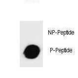 c-Kit / CD117 Antibody - Dot blot of Phospho-mouse KIT-T357 Antibody Phospho-specific antibody on nitrocellulose membrane. 50ng of Phospho-peptide or Non Phospho-peptide per dot were adsorbed. Antibody working concentrations are 0.6ug per ml.