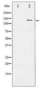 c-Kit / CD117 Antibody - Western blot of KIT phosphorylation expression in EGF treated HepG2 whole cell lysates,The lane on the left is treated with the antigen-specific peptide.