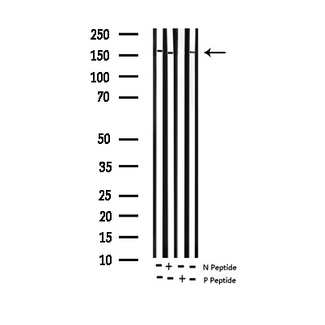 c-Kit / CD117 Antibody - Western blot analysis of Phospho-KIT (Tyr703) expression in various lysates