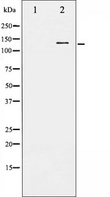 c-Kit / CD117 Antibody - Western blot analysis of KIT phosphorylation expression in EGF treated HepG2 whole cells lysates. The lane on the left is treated with the antigen-specific peptide.