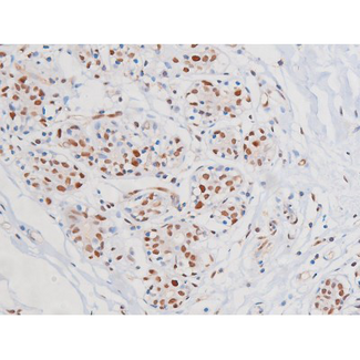c-Kit / CD117 Antibody - 1:200 staining human heart tissue by IHC-P. The tissue was formaldehyde fixed and a heat mediated antigen retrieval step in citrate buffer was performed. The tissue was then blocked and incubated with the antibody for 1.5 hours at 22°C. An HRP conjugated goat anti-rabbit antibody was used as the secondary.