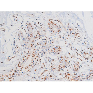 c-Kit / CD117 Antibody - 1:200 staining human heart tissue by IHC-P. The tissue was formaldehyde fixed and a heat mediated antigen retrieval step in citrate buffer was performed. The tissue was then blocked and incubated with the antibody for 1.5 hours at 22°C. An HRP conjugated goat anti-rabbit antibody was used as the secondary.