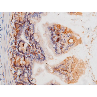 c-Kit / CD117 Antibody - 1:200 staining mouse intestinal tissue by IHC-P. The tissue was formaldehyde fixed and a heat mediated antigen retrieval step in citrate buffer was performed. The tissue was then blocked and incubated with the antibody for 1.5 hours at 22°C. An HRP conjugated goat anti-rabbit antibody was used as the secondary.