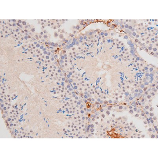 c-Kit / CD117 Antibody - 1:200 staining mouse testis tissue by IHC-P. The tissue was formaldehyde fixed and a heat mediated antigen retrieval step in citrate buffer was performed. The tissue was then blocked and incubated with the antibody for 1.5 hours at 22°C. An HRP conjugated goat anti-rabbit antibody was used as the secondary.