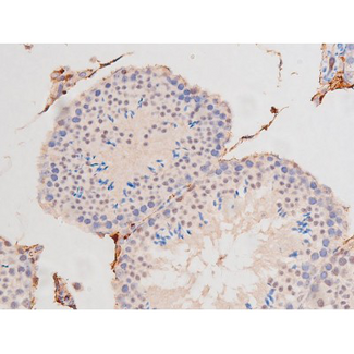 c-Kit / CD117 Antibody - 1:200 staining mouse testis tissue by IHC-P. The tissue was formaldehyde fixed and a heat mediated antigen retrieval step in citrate buffer was performed. The tissue was then blocked and incubated with the antibody for 1.5 hours at 22°C. An HRP conjugated goat anti-rabbit antibody was used as the secondary.