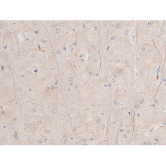 c-Kit / CD117 Antibody - 1:200 staining rat brain tissue by IHC-P. The tissue was formaldehyde fixed and a heat mediated antigen retrieval step in citrate buffer was performed. The tissue was then blocked and incubated with the antibody for 1.5 hours at 22°C. An HRP conjugated goat anti-rabbit antibody was used as the secondary.