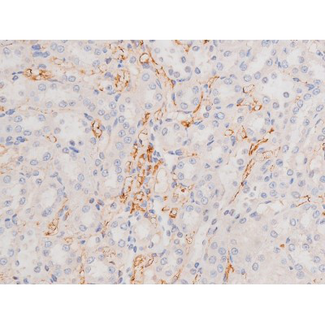 c-Kit / CD117 Antibody - 1:200 staining rat kidney tissue by IHC-P. The tissue was formaldehyde fixed and a heat mediated antigen retrieval step in citrate buffer was performed. The tissue was then blocked and incubated with the antibody for 1.5 hours at 22°C. An HRP conjugated goat anti-rabbit antibody was used as the secondary.