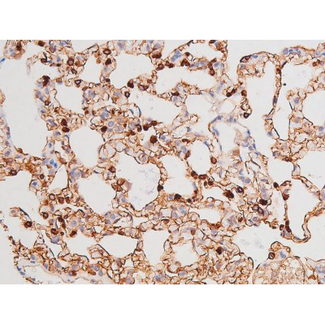 c-Kit / CD117 Antibody - 1:200 staining rat lung tissue by IHC-P. The tissue was formaldehyde fixed and a heat mediated antigen retrieval step in citrate buffer was performed. The tissue was then blocked and incubated with the antibody for 1.5 hours at 22°C. An HRP conjugated goat anti-rabbit antibody was used as the secondary.
