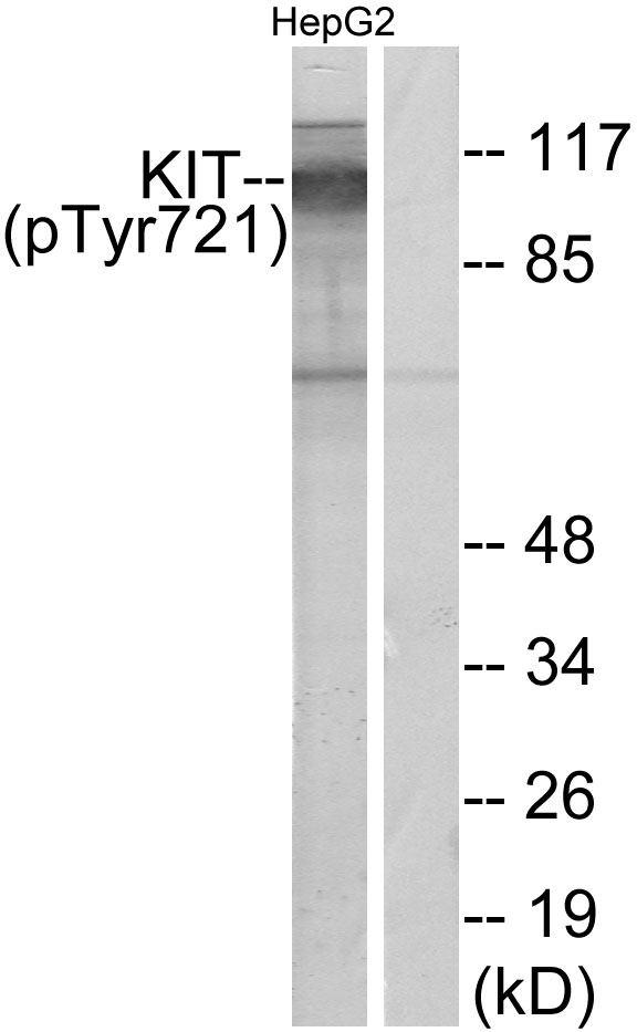 c-Kit / CD117 Antibody - Western blot analysis of lysates from HepG2 cells treated with EGF 200ng/ml 30', using c-Kit (Phospho-Tyr721) Antibody. The lane on the right is blocked with the phospho peptide.