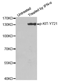 c-Kit / CD117 Antibody - Western blot analysis of extracts from Hela cells.