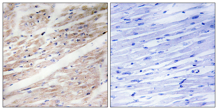 c-Kit / CD117 Antibody - Immunohistochemistry analysis of paraffin-embedded human heart, using KIT (Phospho-Tyr936) Antibody. The picture on the right is blocked with the phospho peptide.