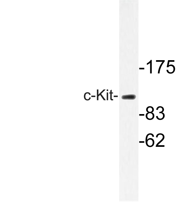 c-Kit / CD117 Antibody - Western blot of c-Kit (S715)pAb in extracts from A549 cells.