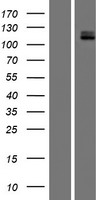 c-Kit / CD117 Protein - Western validation with an anti-DDK antibody * L: Control HEK293 lysate R: Over-expression lysate