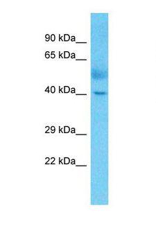 c-Maf Antibody - Western blot of Human Lung Tumor. MAF antibody dilution 1.0 ug/ml.  This image was taken for the unconjugated form of this product. Other forms have not been tested.