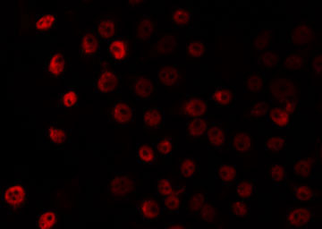 c-Maf Antibody - Staining HuvEc cells by IF/ICC. The samples were fixed with PFA and permeabilized in 0.1% Triton X-100, then blocked in 10% serum for 45 min at 25°C. The primary antibody was diluted at 1:200 and incubated with the sample for 1 hour at 37°C. An Alexa Fluor 594 conjugated goat anti-rabbit IgG (H+L) Ab, diluted at 1/600, was used as the secondary antibody.