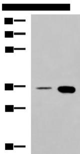 c-Maf Antibody - Western blot analysis of HepG2 cell and Mouse brain tissue lysates  using MAF Polyclonal Antibody at dilution of 1:550