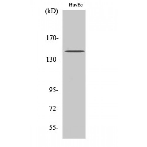 c-Met Antibody - Western blot of Phospho-Met (Y1234) antibody