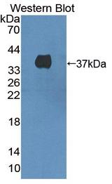 c-Met Antibody - Western blot of c-Met antibody.
