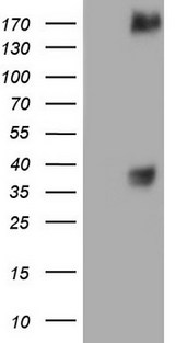 c-Met Antibody - HEK293T cells were transfected with the pCMV6-ENTRY control. (Left lane) or pCMV6-ENTRY MET. (Right lane) cDNA for 48 hrs and lysed. Equivalent amounts of cell lysates. (5 ug per lane) were separated by SDS-PAGE and immunoblotted with anti-MET.