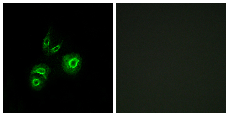 c-Met Antibody - Immunofluorescence analysis of A549 cells, using MET Antibody. The picture on the right is blocked with the synthesized peptide.