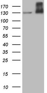 c-Met Antibody - HEK293T cells were transfected with the pCMV6-ENTRY control. (Left lane) or pCMV6-ENTRY MET. (Right lane) cDNA for 48 hrs and lysed. Equivalent amounts of cell lysates. (5 ug per lane) were separated by SDS-PAGE and immunoblotted with anti-MET.