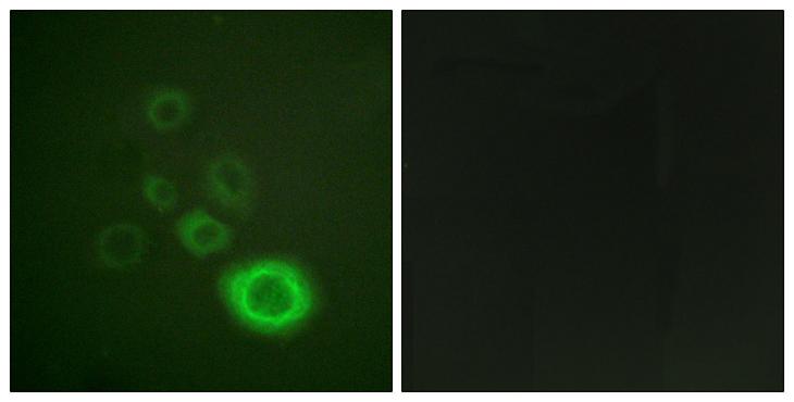 c-Met Antibody - Immunofluorescence analysis of A549 cells, using c-Met Antibody. The picture on the right is blocked with the synthesized peptide.