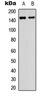 c-Met Antibody - Western blot analysis of c-Met (pY1349) expression in A431 (A); HepG2 (B) whole cell lysates.